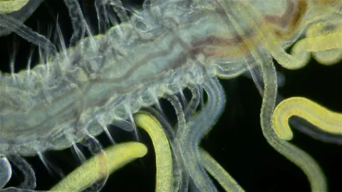 Worm Polychaeta under a microscope. Family Cirratulidae. Stock Footage 165535317