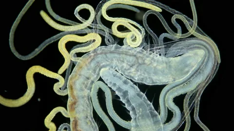 Worm Polychaeta under a microscope. Family Cirratulidae. Video stock 236450641