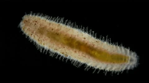 Worm Polychaeta under a microscope, Polynoidae family. Stock Footage 231290292
