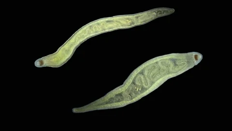 Worm Tetrastemma sp. under the microscope, Nemertea Phylum, vast majority of Stock Footage 139576468