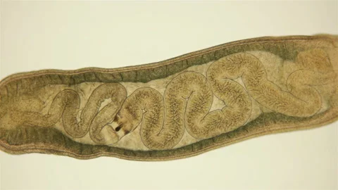 Worm Tetrastemma sp. under the microscope, Nemertea Phylum, vast majority of Stock Footage 139577861