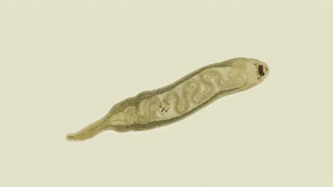 Worm Tetrastemma sp. under the microscope, Nemertea Phylum, vast majority of Stock Footage 160977039