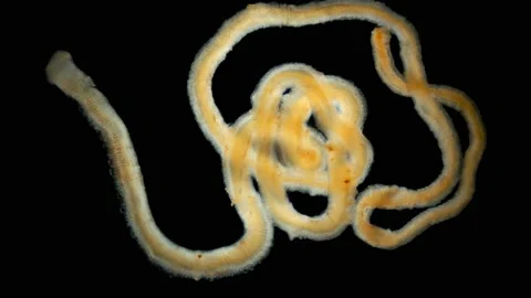 A worm under a microscope, long, like a parasitic. Stock Footage 140185543