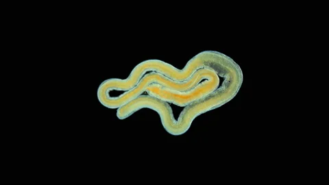 A worm under a microscope, long, like a parasitic. Stock Footage 157926924