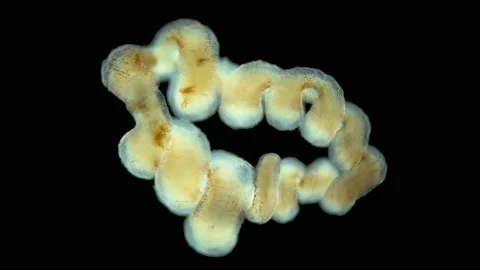 A worm under a microscope, long, like a parasitic. Stock Footage 157927279