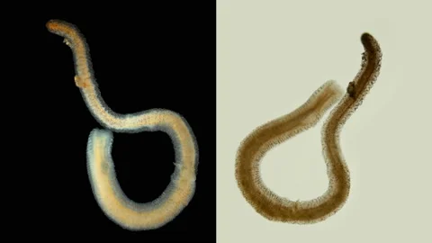 A worm under a microscope,, like a parasitic. Stock Footage 140186925