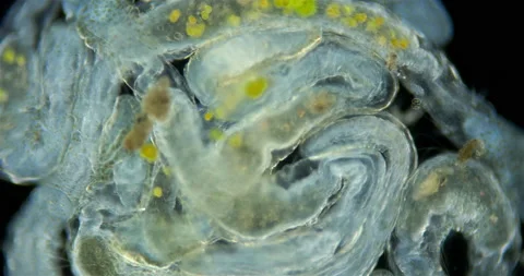 Worms Aeolosoma sp. under a microscope, Aeolosomatidae family. They live on Stock Footage 160470961