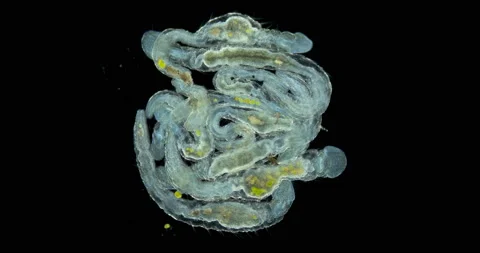 Worms Aeolosoma sp. under a microscope, Aeolosomatidae family. They live on Stock Footage 160471454