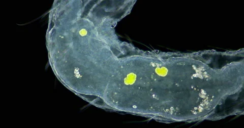 Worms Aeolosoma sp. under a microscope, Aeolosomatidae family. They live on Video stock 160474087