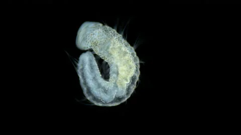 Worms Aeolosoma sp. under a microscope, Aeolosomatidae family. They live on Stock Footage 222910816