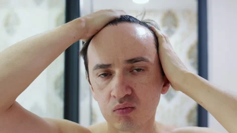 Worried man checking his receding hairline and hair loss in a mirror Stock Footage 344278614