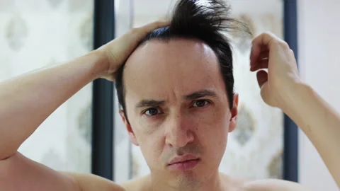 Worried man checking his receding hairline Stock Footage 344278721
