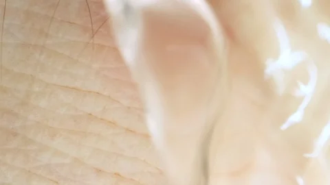 Wound and bleeding at leech bite. Close-up Stock Footage 114878645