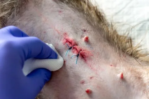 Wound care Stock Photos
