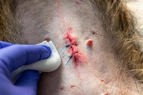 Wound care Stock Photos