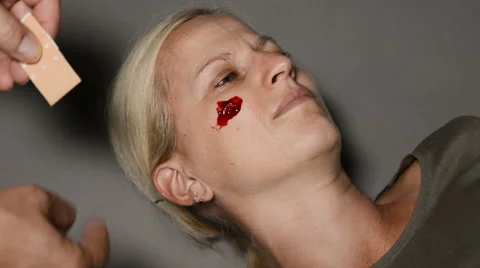 Wound on cheek Stock Footage 68755596