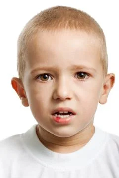Wound child Foto stock