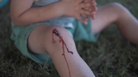 Wound On Knee Stock Footage 95085366