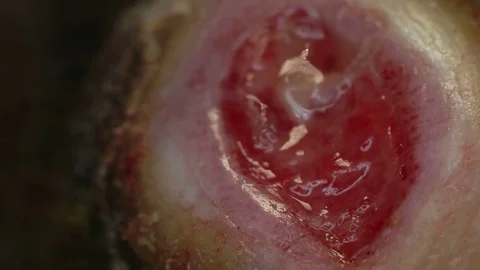 Wound Macro Shot Stock Footage