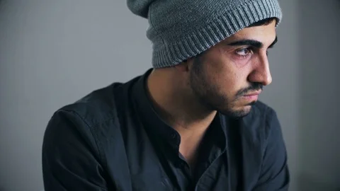 Wounded and beaten young man looks at the camera Stock Footage