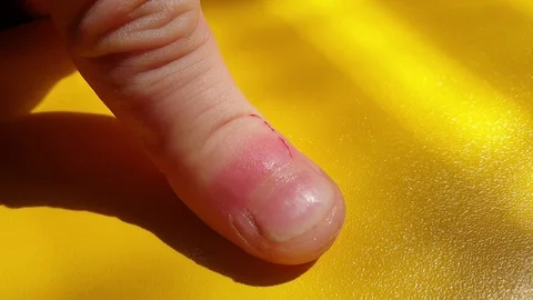 Wounded finger. Cut a finger. Bleeding finger. Stock Footage 112323396