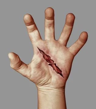 Wounded hand Illustrazione stock