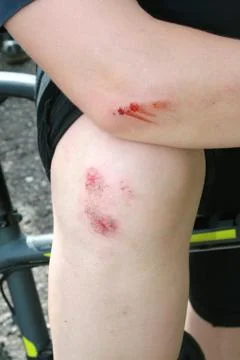 Wounded knee Stock Photos