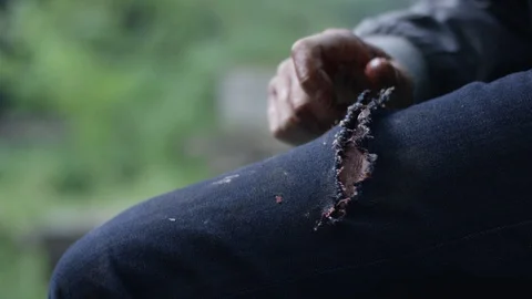 Wounded in the leg man Vidéo 113444790