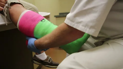 Wrapping Cast on Leg Vidéo 49546183