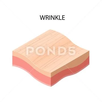 Wrinkle formation cross-section of human skin layers structure skincare ...