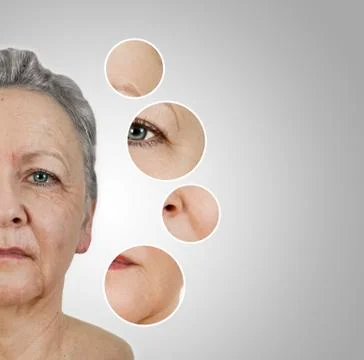 Wrinkle smoothing Fotos de archivo