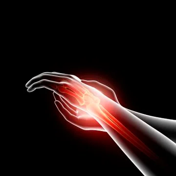 Wrist pain, artwork Stock Illustration