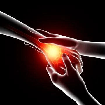 Wrist pain, artwork Stock Illustration