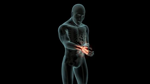 Wrist Pain 스톡 동영상 121969172