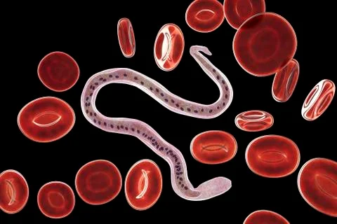 Wuchereria bancrofti, the causative agent of lymphatic filariasis Ilustração Stock