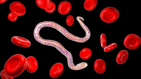 Wuchereria bancrofti, the causative agent of lymphatic filariasis Ilustração Stock