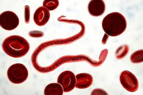 Wuchereria bancrofti, the causative agent of lymphatic filariasis Ilustração Stock