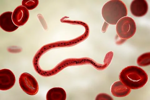 Wuchereria bancrofti, the causative agent of lymphatic filariasis Stock Illustration