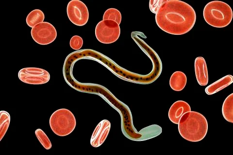 Wuchereria bancrofti, the causative agent of lymphatic filariasis Ilustração Stock
