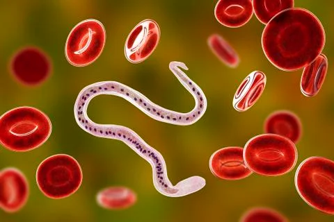 Wuchereria bancrofti, the causative agent of lymphatic filariasis Stock Illustration