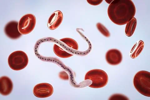 Wuchereria bancrofti, the causative agent of lymphatic filariasis Ilustração Stock