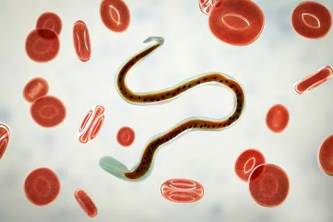 Wuchereria bancrofti, the causative agent of lymphatic filariasis Ilustração Stock