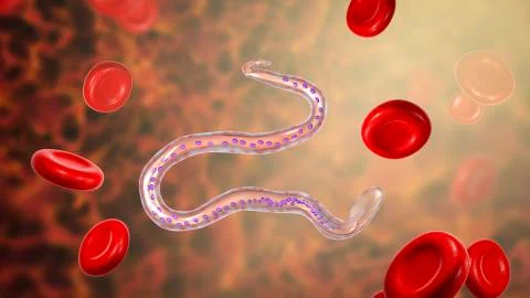 Wuchereria bancrofti, the causative agent of lymphatic filariasis Stock Illustration