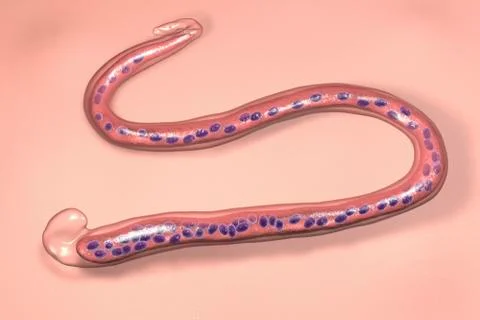 Wuchereria bancrofti, a roundworm nematode, one of the causative agents of ly Stock Illustration