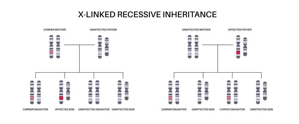 X linked recessive inheritance Stock Illustration