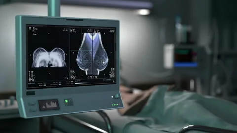 X-ray analysis of the chest for breast cancer prevention at a healthcare clinic Stock Footage 243111461