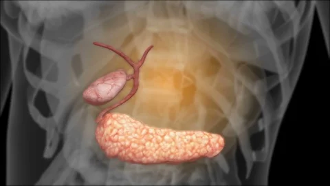 X-ray of the biliary Stock Footage 74095328