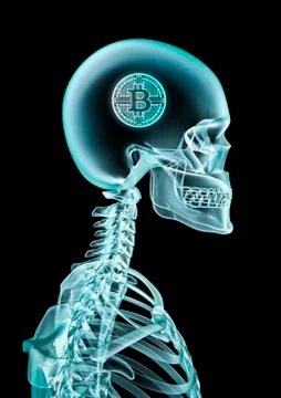 X-ray bitcoin concept Stock-Illustration