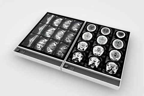 X-Ray Boards Stock Illustration