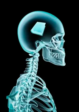 X-ray book lover Illustrazione stock